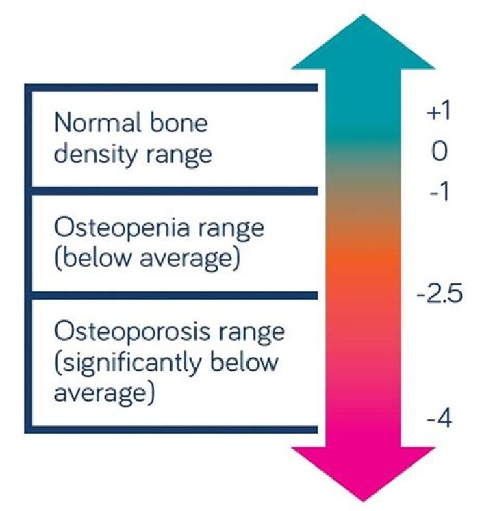 What are the symptoms of low bone density