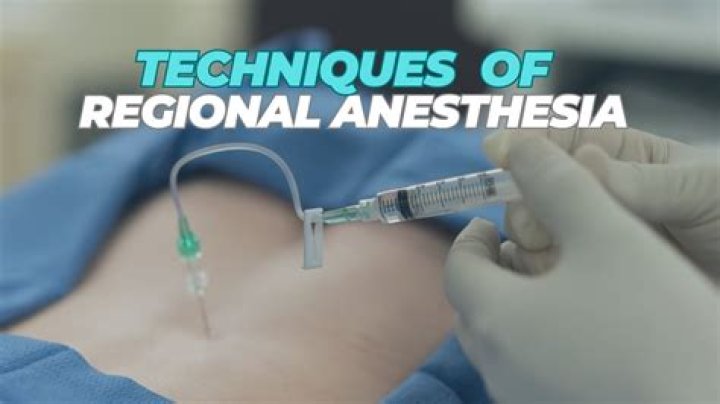 What is a regional anesthesia